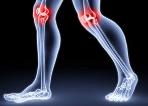 The causes of knee osteoarthritis development